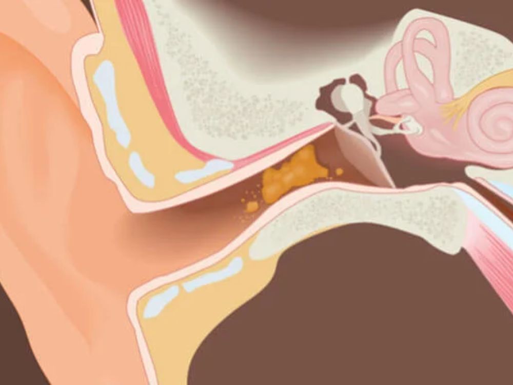 ¿Para qué sirve la cera del oído?