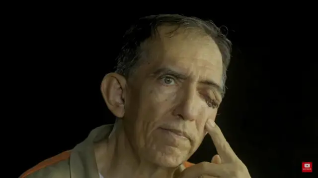 Retrato penitenciario de Luis Alfredo Garavito, con evidente deterioro físico en el rostro, especialmente en el área ocular izquierda. Imagen de archivo que refleja el ocaso biológico del mayor asesino serial colombiano