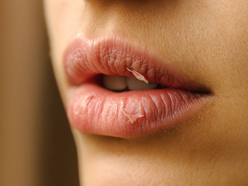 Primer plano de unos labios humanos con descamación epitelial leve, iluminados con luz cálida